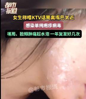 升融配资 “终身携带，无药可治……”女子唱K离话筒太近感染病毒